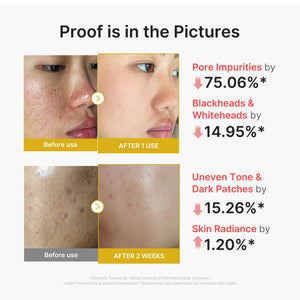Kojic Acid Turmeric Peel Shot for Blackheads and Dull Skin