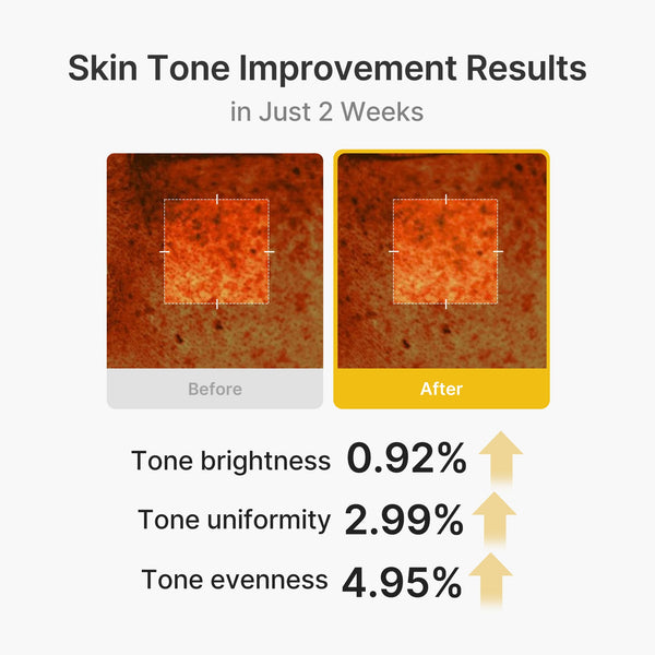 Kojic Acid Turmeric Vita Capsule Cream for Dark Spots and Glow