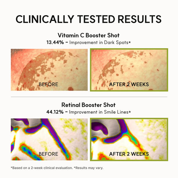 Booster Shot Skin Renewal Duo with Vitamin C and Retinal for Brightening