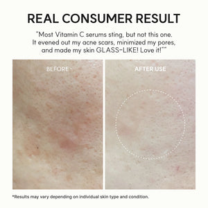 Vitamin C Booster Shot Serum with Glutathione & Pure Vitamin C