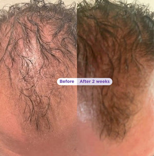 Biotin & Rosemary Thickening Shampoo & Conditioner Set for Fuller, Thicker-Looking Hair