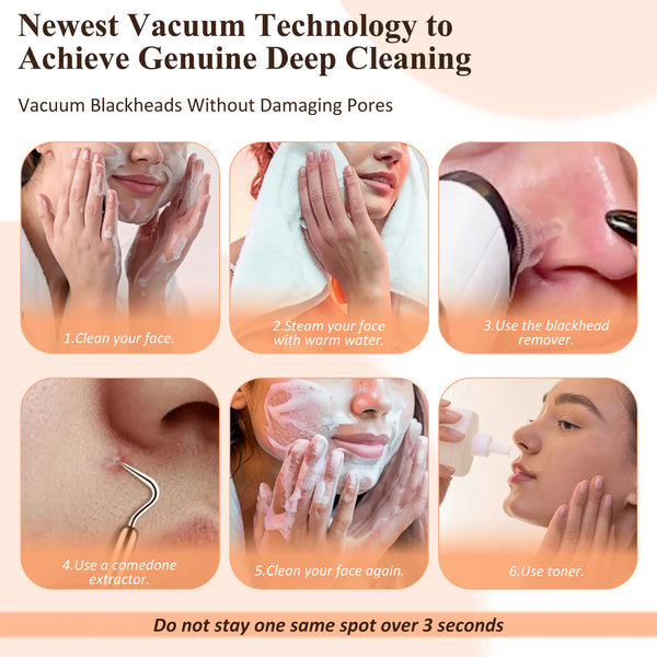 Blackhead Remover Pore Vacuum, USB Rechargeable, 3 Suction Levels