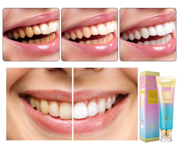 Niacinamide Whitening Toothpaste featuring Triple Whitening Complex