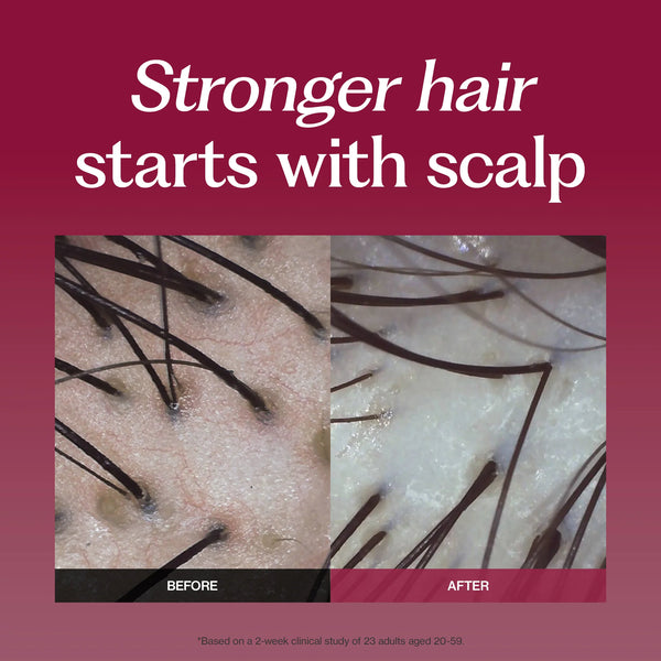 Forte Silk Protein Peptide Hair Care Duo for Scalp Care, Thinning Hair, Damaged Strands & Hair Strength