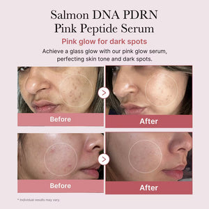 PDRN Pink Peptide Serum with Salmon PDRN for Glass Skin and Glow