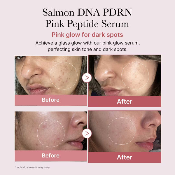 PDRN Pink Peptide Serum with Salmon PDRN for Glass Skin and Glow