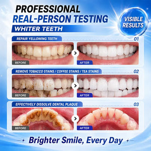 8X Niacinamide Foaming Toothpaste for Teeth Whitening, Stain Removal & Fresh Breath