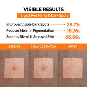 Blemish & Dark Spot Patch Duo with Salicylic Acid & Niacinamide