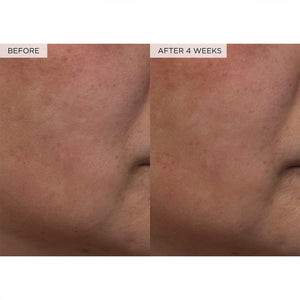 PHA + BHA Pore Tight Toner with Watermelon Extract & Glycerin for Pore
