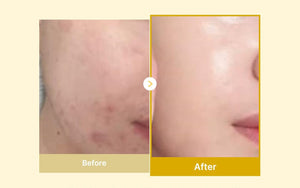 Kojic Acid & Turmeric Overnight Peel-Off Mask featuring Vitamin C & Retinol