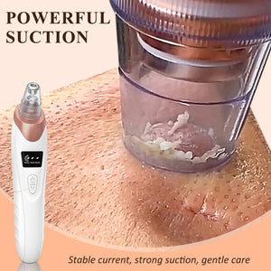 Blackhead Remover Pore Vacuum, USB Rechargeable, 3 Suction Levels