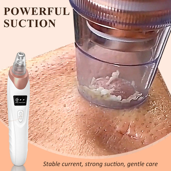 Blackhead Remover Pore Vacuum, USB Rechargeable, 3 Suction Levels