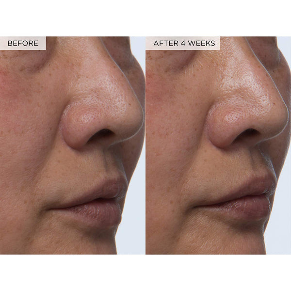 PHA + BHA Pore Tight Toner with Watermelon Extract & Glycerin for Pore