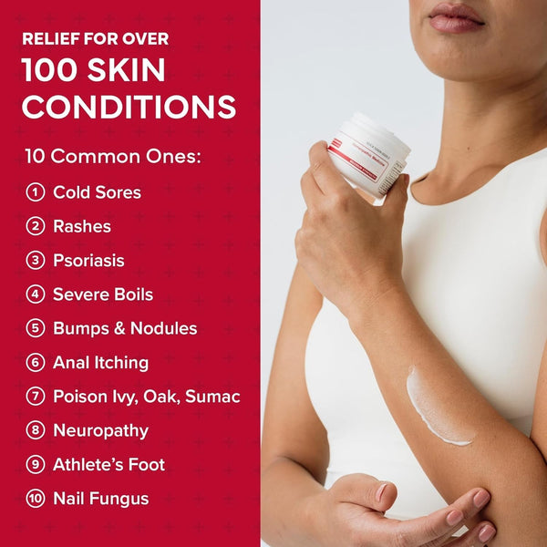 EMUAIDMAX Cream for Itchy Skin Advanced Soothing Care for Sensitive Skin