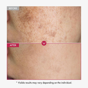 Niacinamide 10% + Tranexamic Acid 4% Serum for Glass Skin