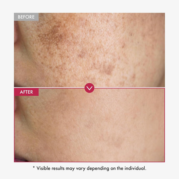 Niacinamide 10% + Tranexamic Acid 4% Serum for Glass Skin
