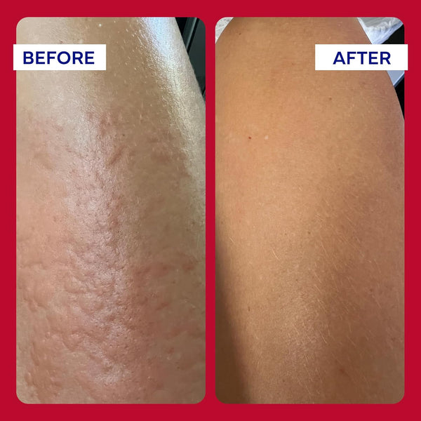 EMUAIDMAX Cream for Itchy Skin Advanced Soothing Care for Sensitive Skin