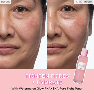 PHA + BHA Pore Tight Toner with Watermelon Extract & Glycerin for Pore