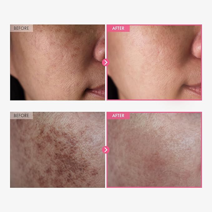 Brightening Cream with Arbutin 7% & Tranexamic Acid 4% — Niacinamide & Glutathione for Dark Spots, 50ml