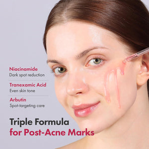Niacinamide 10% + Tranexamic Acid 4% Serum for Glass Skin