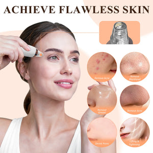 Blackhead Remover Pore Vacuum, USB Rechargeable, 3 Suction Levels