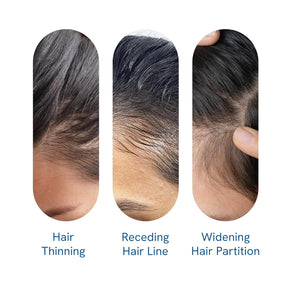 Rosemary Scalp Serum Roll-On – Redensyl & Anagain Hair Growth Activator