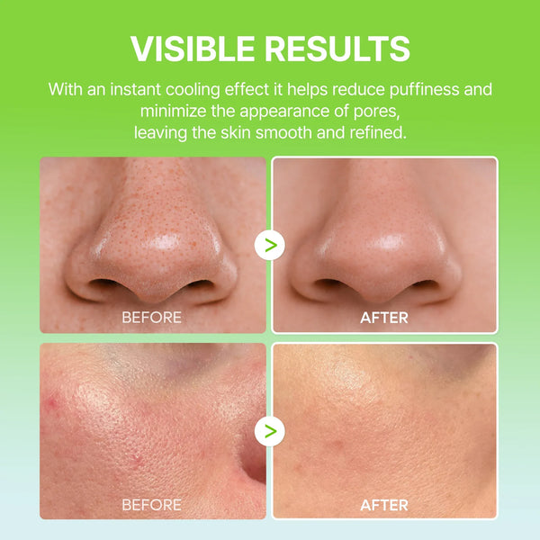 CACTOX Pore Relief Multi Balm for Pores, Puffiness & Skin Texture