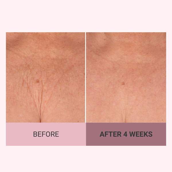 Champagne Firming Body Cream — Luxe-Lift Complex & Pink Pepperslim Firming Formula