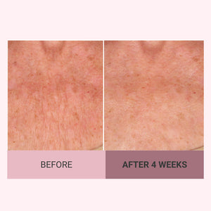 Champagne Firming Body Cream — Luxe-Lift Complex & Pink Pepperslim Firming Formula