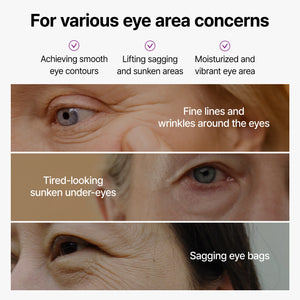 Calcium Bonding Eye Cream for Under Eyes and Fine Lines