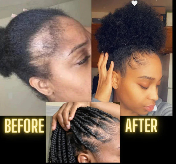 Moisturize & Seal Bundle for Dry Hair, Scalp Care and Fuller-Looking Hair