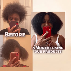 Moisturize & Seal Bundle for Dry Hair, Scalp Care and Fuller-Looking Hair