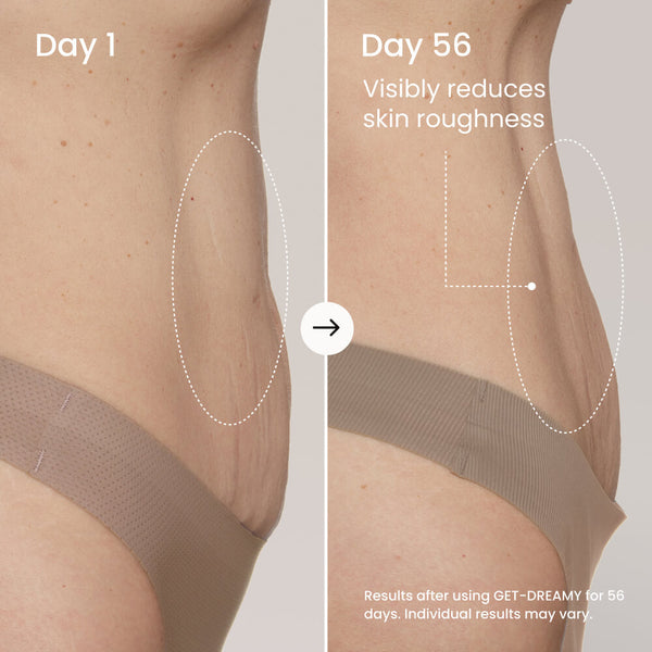 GET-DREAMY Overnight Toning Body Whip featuring Milk Thistle & Magnesium
