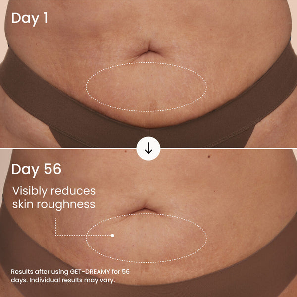 GET-DREAMY Overnight Toning Body Whip featuring Milk Thistle & Magnesium