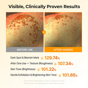 Kojic Acid Turmeric TX Toner Pads for Dark Spots and Uneven Skin Tone