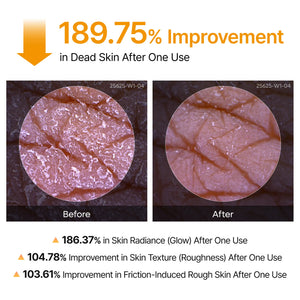 Peel Shot Kojic Acid Turmeric Duo for Dark Spots and Uneven Tone