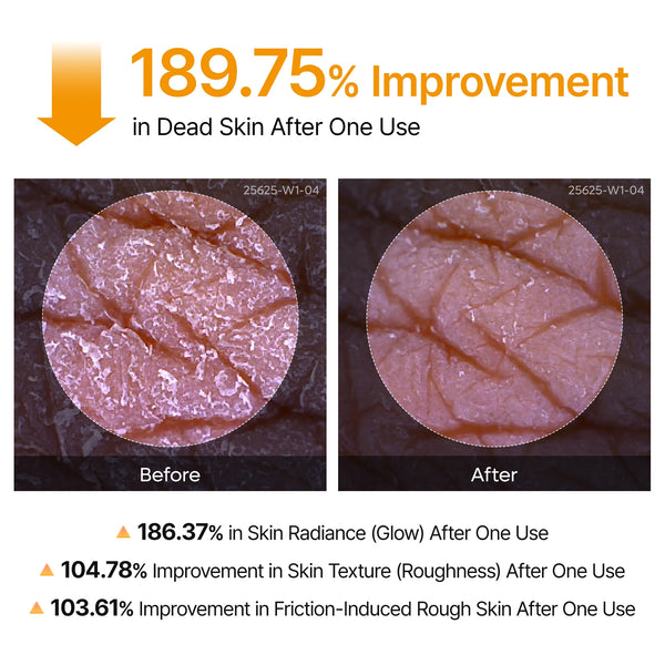 Peel Shot Kojic Acid Turmeric Duo for Dark Spots and Uneven Tone