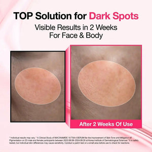 Dark Spot Brightening Serum with Niacinamide, Tranexamic Acid & Arbutin