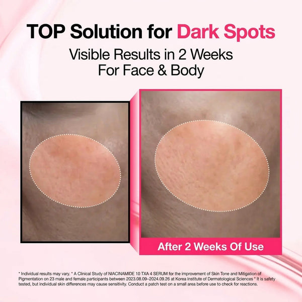 Dark Spot Brightening Serum with Niacinamide, Tranexamic Acid & Arbutin