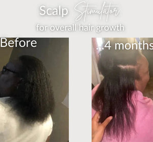 Moisturize & Seal Bundle for Dry Hair, Scalp Care and Fuller-Looking Hair