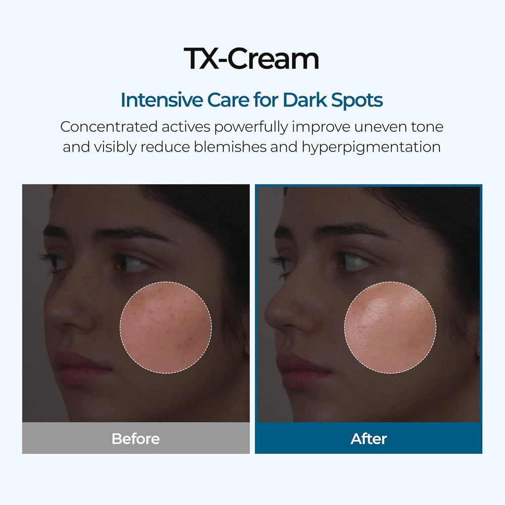 TX Tranexamic Acid Cream for Dark Spots, Freckles and Blemishes