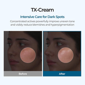 TX Tranexamic Acid Cream for Dark Spots, Freckles and Blemishes