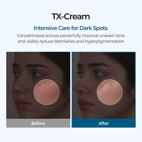 TX Tranexamic Acid Cream for Dark Spots, Freckles and Blemishes