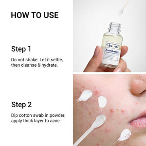 Salicylic Acid Drying Lotion with Niacinamide, Sulfur & Zinc Oxide for Acne