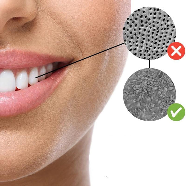 Underbrush Remineralizing Chewing Gum featuring Nano-Hydroxyapatite