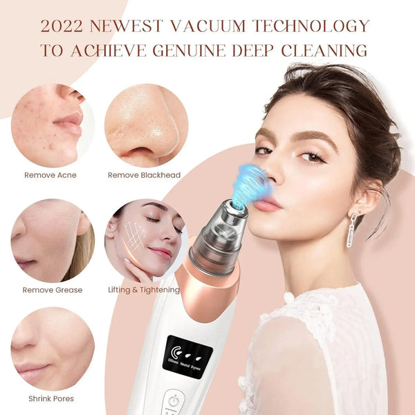 Blackhead Remover Pore Vacuum, USB Rechargeable, 3 Suction Levels