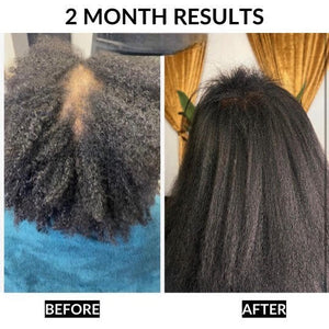 Healthy Hair Starter Kit 6-Piece Complete Hair Care Bundle for Stronger Hair