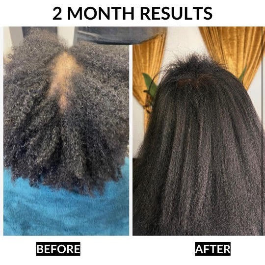 Healthy Hair Starter Kit 6-Piece Complete Hair Care Bundle for Stronger Hair