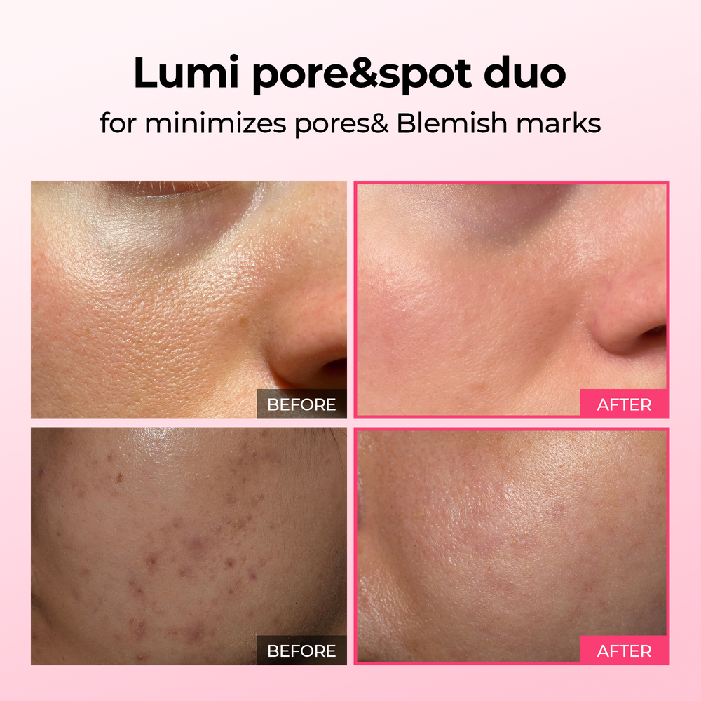 Lumi Pore & Spot Care Clarifying & Brightening Serum Duo Set, 30ml + 30ml