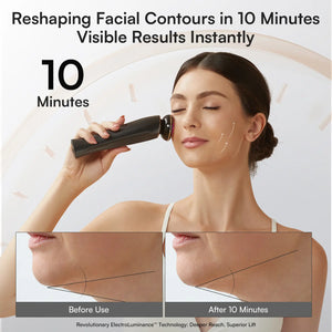 FLARE All-in-One Facial Beauty Device, 3-in-1 Lift, Tighten, Infuse
